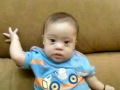 Down syndrome:&nbsp;S�ndrome de Down: KEYNER JOSE EL DUE�O DE MI VIDA
