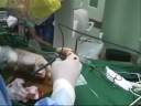PCNL (Percutaneous Nephrolithotomy & Ultrasonic Lithotripsy) .wmv