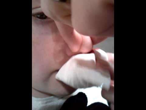 how to drain runny nose
