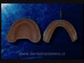 Protesis Dental 4