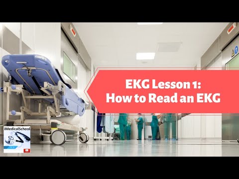 how to read an ekg