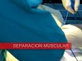 CESAREA CESAREA