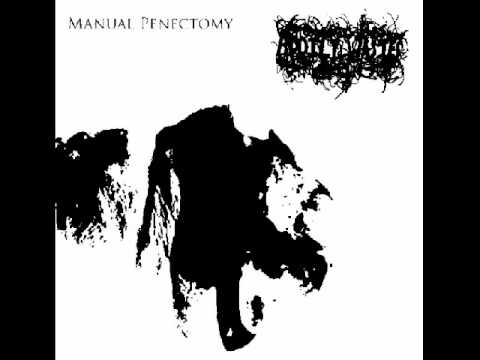 penectomy