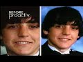 Lindsay Lohan ProActiv Commercial Lindsay Lohan ProActiv Commercial