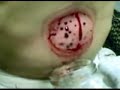 arabs abuse chinese medicine