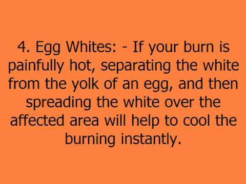 how to relieve sunburn sting