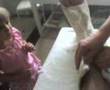 Taking off my cast