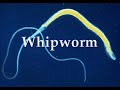 Worms/Parasites - Remedies