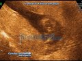 16 Semanas, 4 días de embarazo