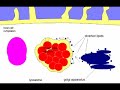 Chlamydia