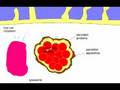 Chlamydia