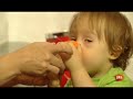 Down syndrome:&nbsp;La historia de Jan 