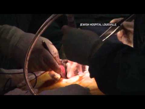 Team Seeks to 3-D Print Working Human Heart