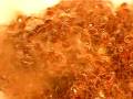 videos de tick larvae 1.MOV