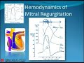 Part 3:pcc_reviewer Valvular Heart Disease (MR)