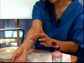 How to Treat Insect Bites & Stings : How to Reduce the Swelling of an Insect Bite