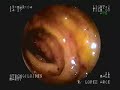 Strongyloides-Maruy