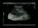 Baby de Sofia Vargas / Angelo Uriel Vargas Baby de Sofia Vargas / Angelo Uriel Vargas