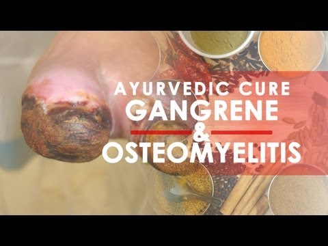 how to cure osteomyelitis