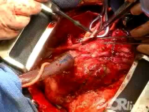 Advancements in Technology