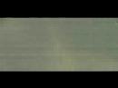 Static Displasia