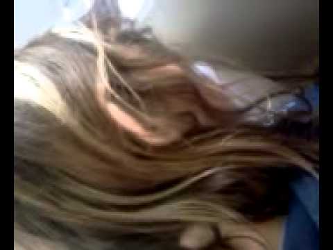 how to cure rug burn