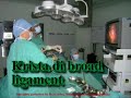 pembedahan laparoscopy - kista ovarium