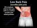 Sacroiliac Joint Animation ,low back pain - Everything You Need To Know - Dr. Nabil Ebraheim, MD