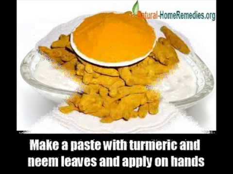 how to cure dry hands