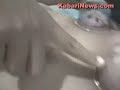 Terapi Bekam (Video 1), KabariNews.com - Jembatan Informasi Indonesia Amerika