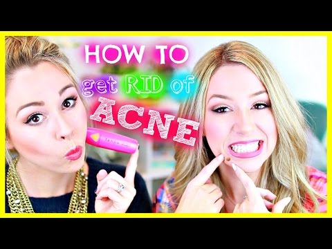 how to get rid of acne with in a day