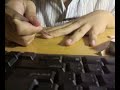 Self-mutilation