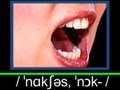 English Pronunciation Lesson - NOXIOUS - #260 - 発音練習 - 学英语