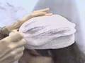Bandaging