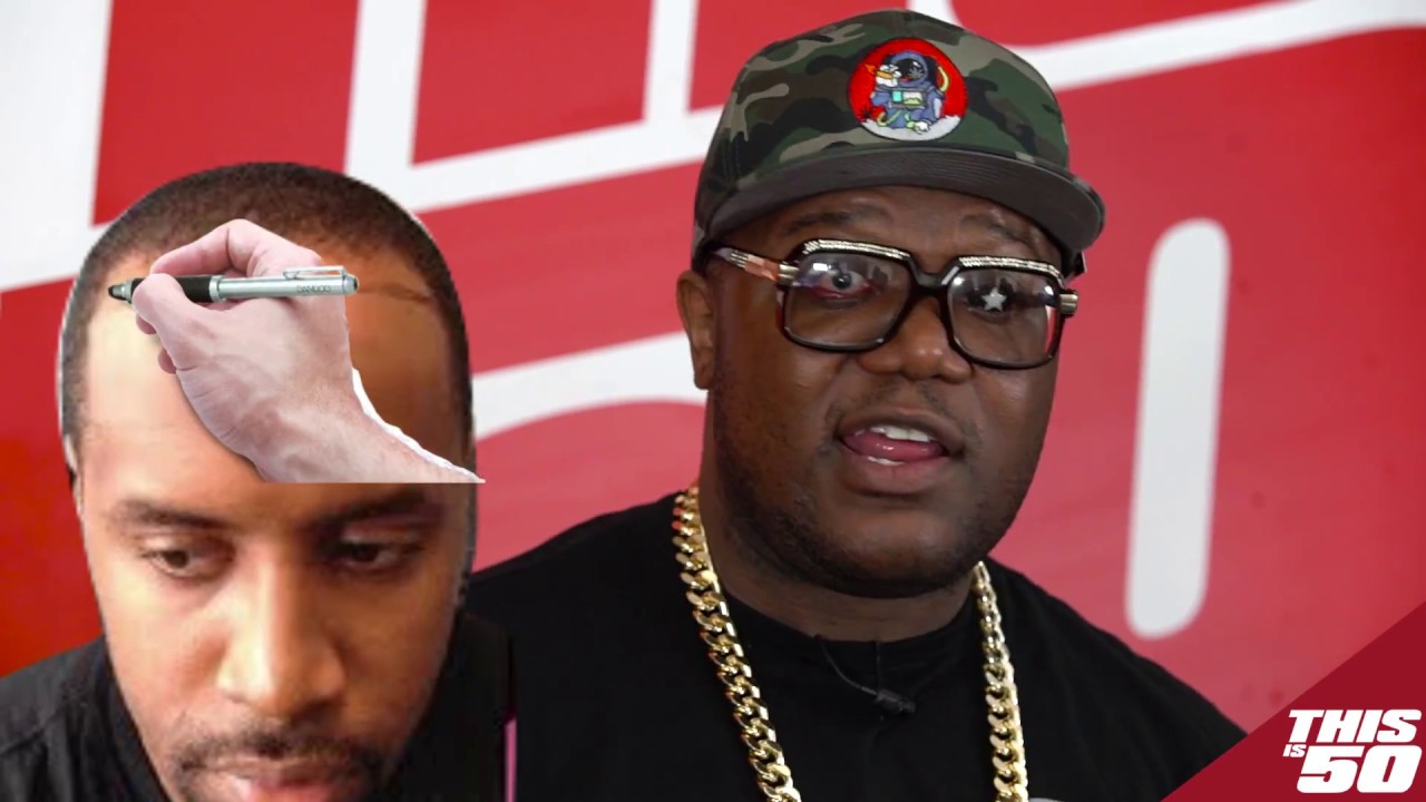 SO Disrespectful | Would You Pay $12K  For a New Hairline + Sidechicks Gone Wild - Trump VS Omarosa