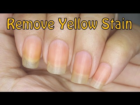how to remove yellow stains