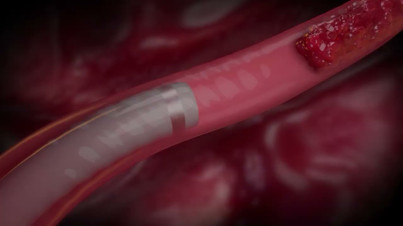 THUNDERBOLT DFI Animation Video