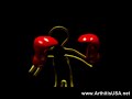 Dr Farshchian s Regenerative Medicine and Boxer's fracture