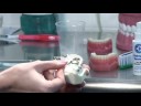 Teeth Whitening : What is a Palate Expander?