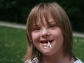 Down syndrome:&nbsp;S�ndrome de Down: Bon Nadal 2012