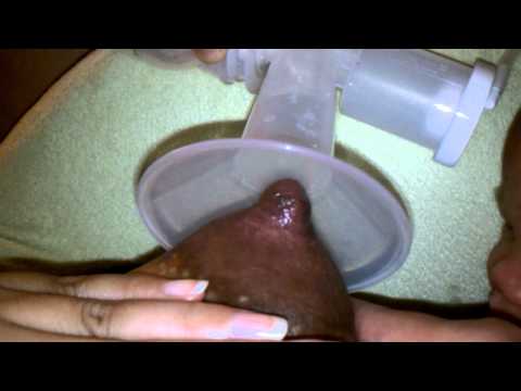 how to unclog milk duct while pumping
