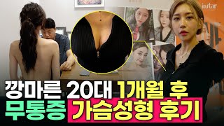 인스타성형외과