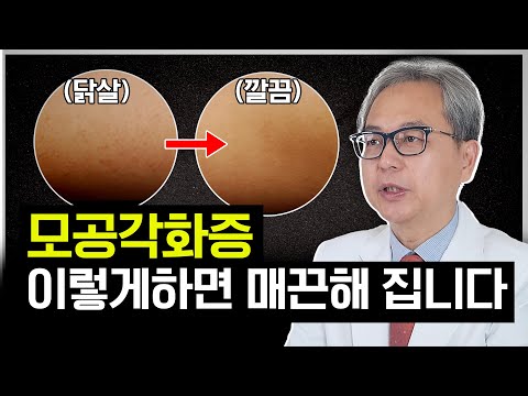 연세스타피부과 TV