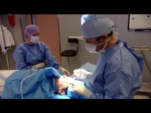 Ooglidcorrectie door dokter Luijendijk