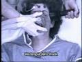 Psichiatria ECT - Distruggere Vite