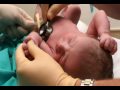 Respiratory syncytial virus (RSV)