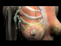 Breast Cancer Progression and Staging