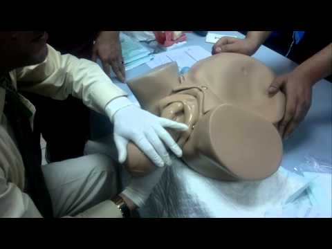 شرح طريقة الولادة د.جمال