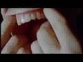 Agoraphobic Nosebleed - Mosquito Holding Human Cattle Prod