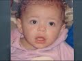 baby shaken to near death